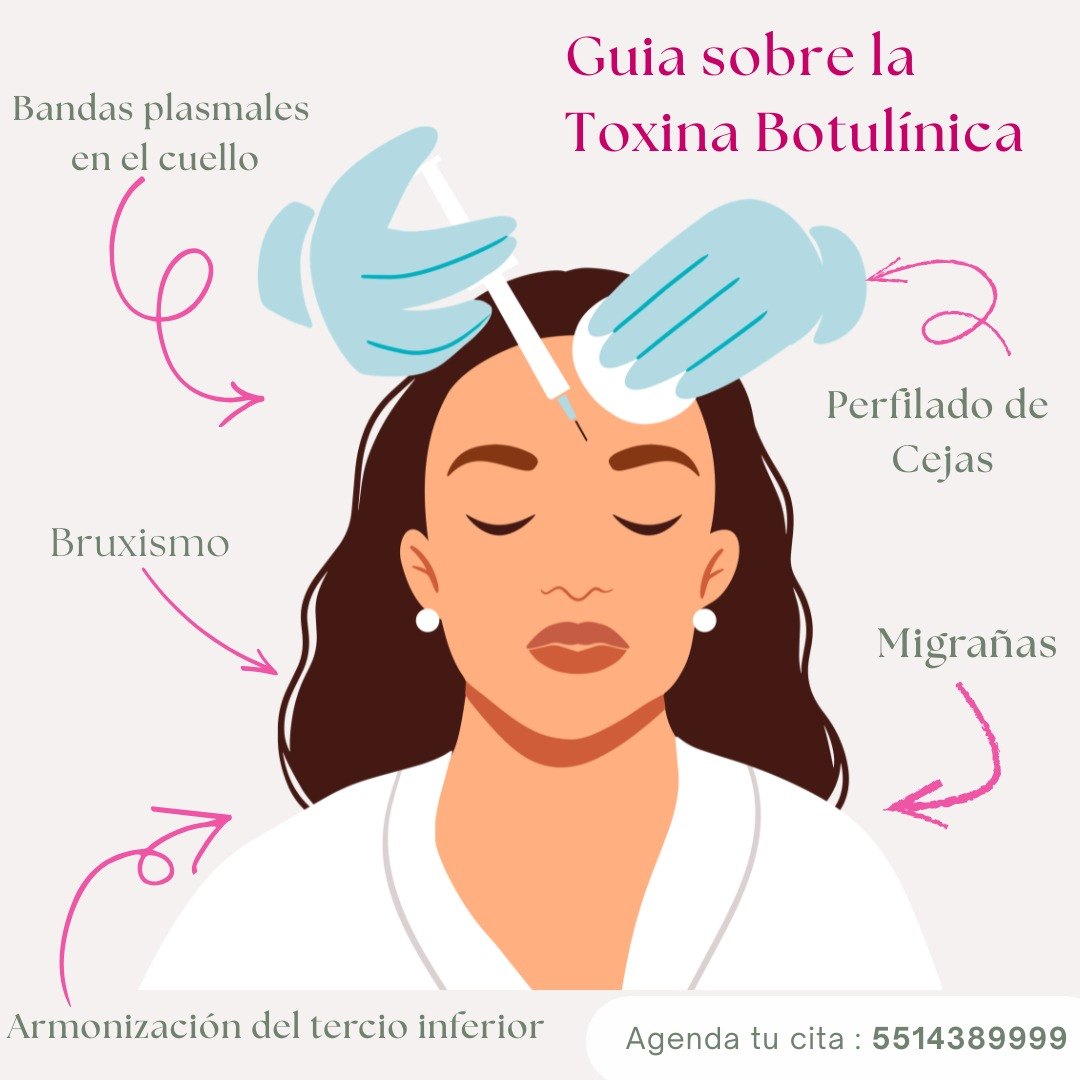 Guía de toxina botulínica